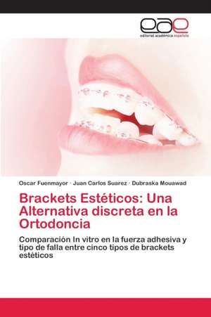 Brackets Estéticos: Una Alternativa discreta en la Ortodoncia de Oscar Fuenmayor