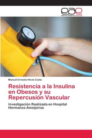 Resistencia a la Insulina en Obesos y su Repercusión Vascular de Manuel Ernesto Hevia Costa