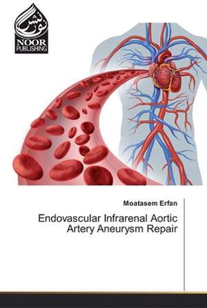 Endovascular Infrarenal Aortic Artery Aneurysm Repair de Moatasem Erfan