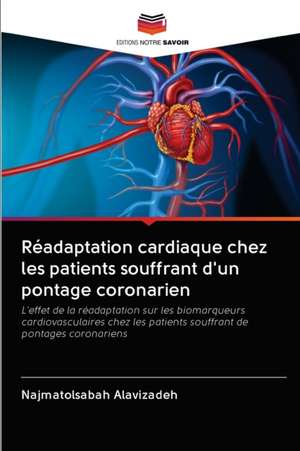 Réadaptation cardiaque chez les patients souffrant d'un pontage coronarien de Najmatolsabah Alavizadeh