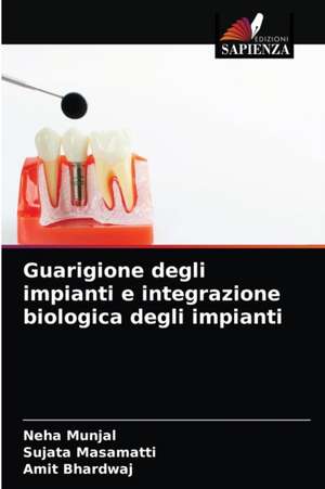 Guarigione degli impianti e integrazione biologica degli impianti de Neha Munjal