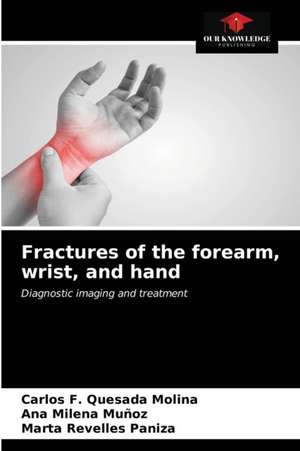 Fractures of the forearm, wrist, and hand de Carlos F. Quesada Molina