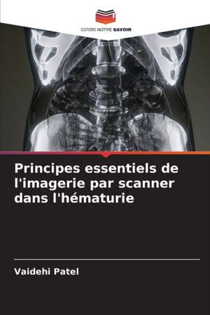 Principes essentiels de l'imagerie par scanner dans l'hématurie de Vaidehi Patel