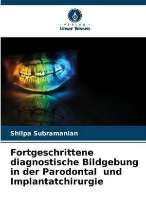 Fortgeschrittene diagnostische Bildgebung in der Parodontal und Implantatchirurgie de Shilpa Subramanian