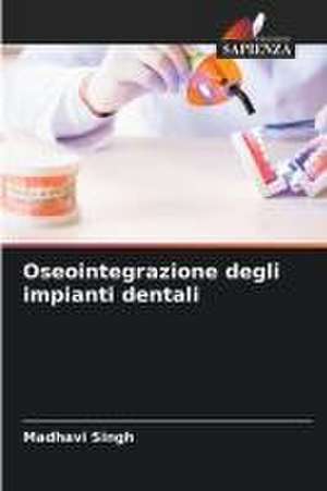 Oseointegrazione degli impianti dentali de Madhavi Singh