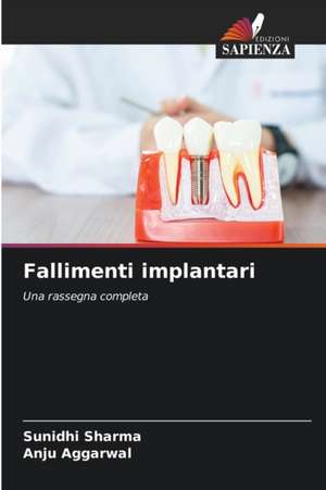 Fallimenti implantari de Sunidhi Sharma