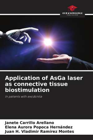 Application of AsGa laser as connective tissue biostimulation de Janete Carrillo Arellano