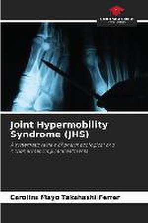 Joint Hypermobility Syndrome (JHS) de Carolina Mayo Takahashi Ferrer