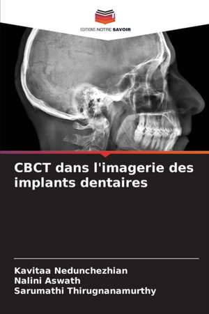 CBCT dans l'imagerie des implants dentaires de Kavitaa Nedunchezhian