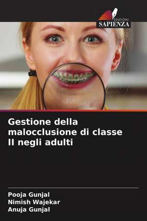 Gestione della malocclusione di classe II negli adulti de Pooja Gunjal