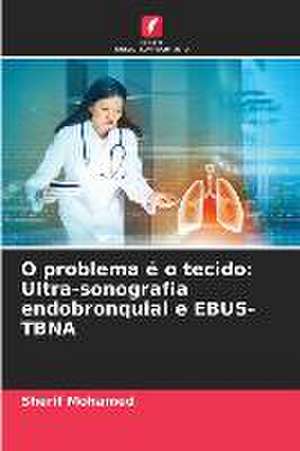 O problema é o tecido: Ultra-sonografia endobronquial e EBUS-TBNA de Sherif Mohamed