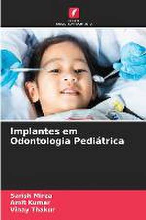 Implantes em Odontologia Pediátrica de Sarish Mirza