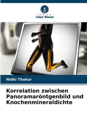 Korrelation zwischen Panoramaröntgenbild und Knochenmineraldichte de Nidhi Thakur