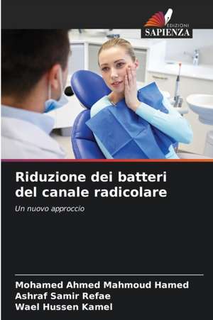 Riduzione dei batteri del canale radicolare de Mohamed Ahmed Mahmoud Hamed