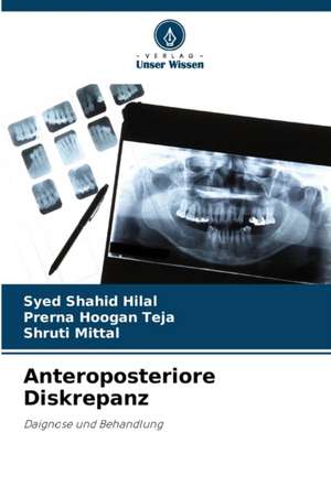 Anteroposteriore Diskrepanz de Syed Shahid Hilal