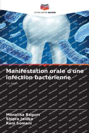 Manifestation orale d'une infection bactérienne de Monalisa Begum