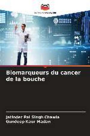 Biomarqueurs du cancer de la bouche de Jatinder Pal Singh Chawla