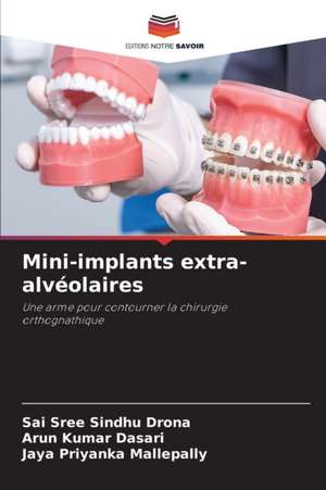 Mini-implants extra-alvéolaires de Sai Sree Sindhu Drona