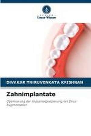 Zahnimplantate de Divakar Thiruvenkata Krishnan