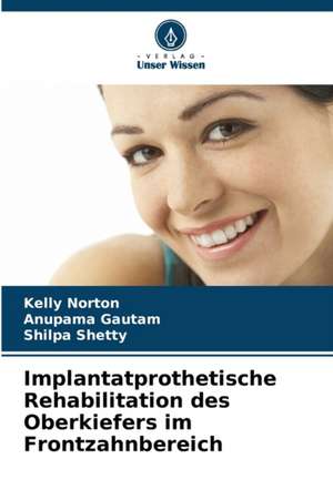 Implantatprothetische Rehabilitation des Oberkiefers im Frontzahnbereich de Kelly Norton