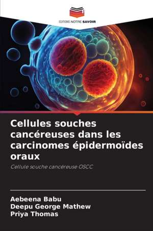 Cellules souches cancéreuses dans les carcinomes épidermoïdes oraux de Aebeena Babu