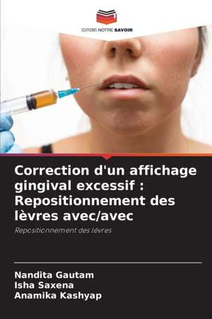 Correction d'un affichage gingival excessif : Repositionnement des lèvres avec/avec de Nandita Gautam