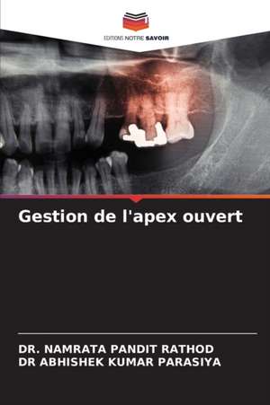 Gestion de l'apex ouvert de Namrata Pandit Rathod