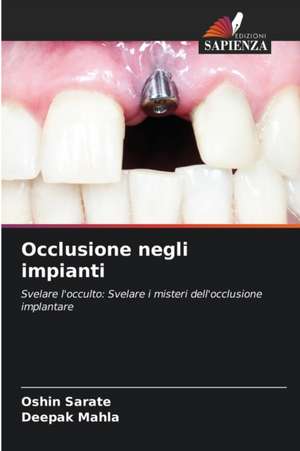 Occlusione negli impianti de Oshin Sarate