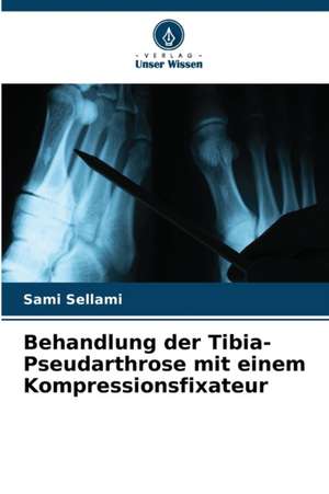 Behandlung der Tibia-Pseudarthrose mit einem Kompressionsfixateur de Sami Sellami