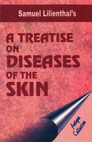 Treatise on Diseases of the Skin de MD Lilienthal, Samuel