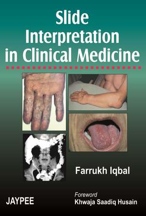 Slide Interpretation in Clinical Medicine de Farrukh Iqbal