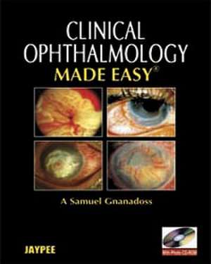 Clinical Ophthalmology Made Easy de Anina Abraham