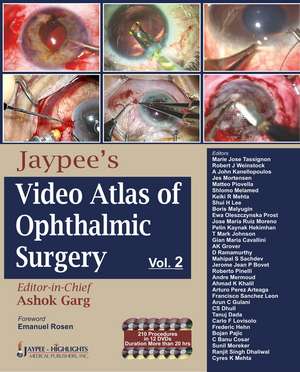 Jaypee's Video Atlas of Ophthalmic Surgery: Volume II de Ashok Garg