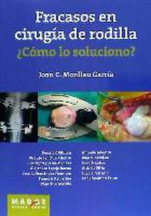 Fracasos en cirugía de rodilla ¿Cómo lo soluciono? de Juan C Monllau García