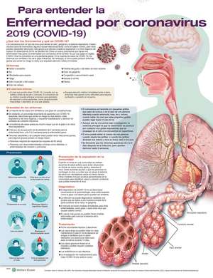 Para entender la Enfermedad por coronavirus 2019 (COVID-19) de Anatomical Chart Company