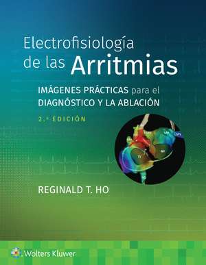 Electrofisiología de las arritmias: Imágenes prácticas para el diagnóstico y la ablación de Reginald T. Ho MD