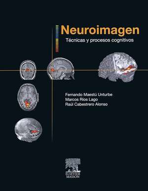 Neuroimagen : técnicas y procesos de Raúl Cabestrero Alonso