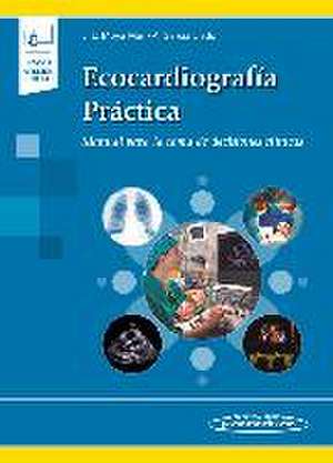 Ecocardiografía práctica de José Luis Moya Mur