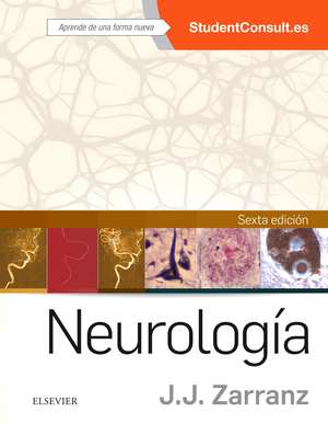 Neurología de Juan J. Zarranz