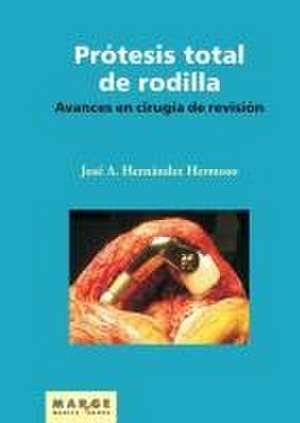 Avances en cirugía de revisión de la prótesis total de rodilla de José Antonio Hernández Hermoso