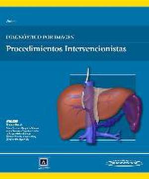 Diagnóstico por imagen : procedimientos intervencionistas de Gregory Walker