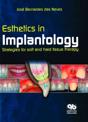 Esthetics in Implantology: Strategies for Soft and Hard Tissue Therapy de José Bernardes das Neves