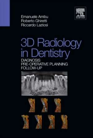 D radiology in dentistry - Diagnosis Pre-operative Planning Follow-up de Riccardo Laziosi