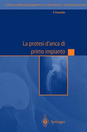 La protesi d'anca di primo impianto de F. Franchin