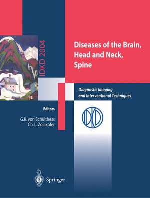 Diseases of the Brain, Head and Neck, Spine: Diagnostic Imaging and Interventional Techniques de Gustav K. Schulthess