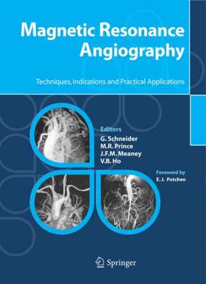 Magnetic Resonance Angiography: Techniques, Indications and Practical Applications de G. Schneider