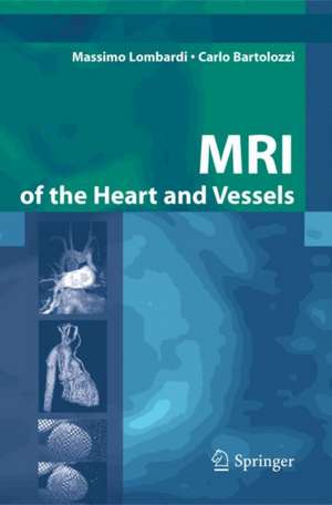 MRI of the Heart and Vessels de Massimo Lombardi