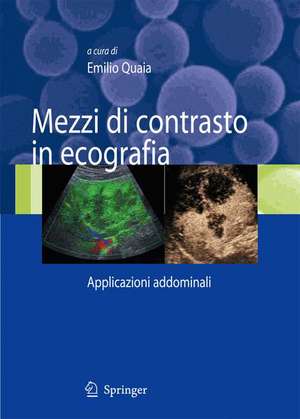 Mezzi di contrasto in ecografia: Applicazioni addominali de Emilio Quaia