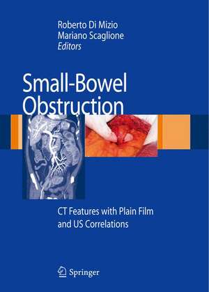 Small-Bowel Obstruction: CT Features with Plain Film and US correlations de Roberto Di Mizio