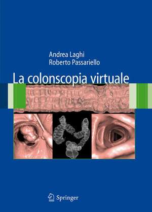 La colonscopia virtuale de Andrea Laghi